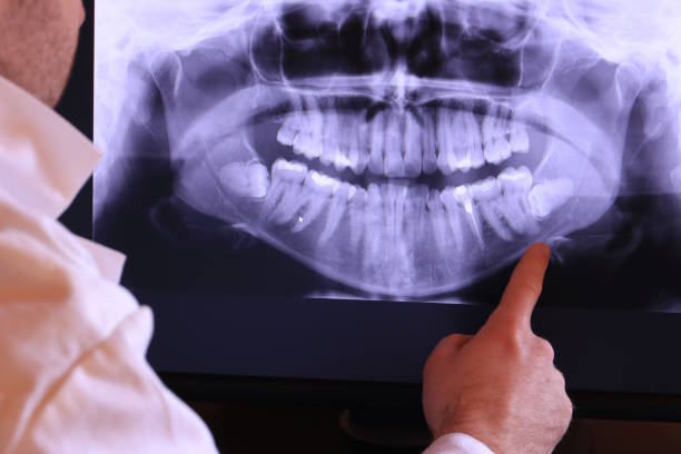 Best Emergency Dental Services for Seniors in Fruita, CO