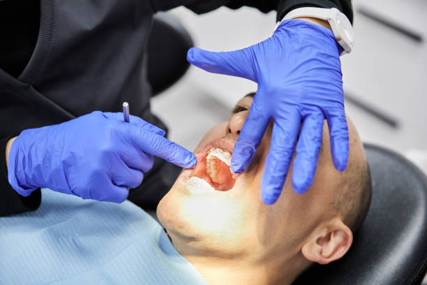 Best Emergency Dentist for Lost Fillings or Crowns in Fruita, CO