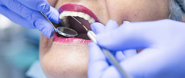 Best Broken or Cracked Tooth Emergency Dentist in Fruita, CO